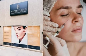 Toxina Botulínica com Retorno Incluso p/ Testa, Olhos e/ou Glabela, a partir de R$315. Amenize as Rugas e Marcas de Expressão!